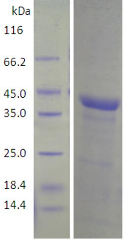 15% SDS-PAGE analysis profiles of purified KP1_1632-276-597 (CBB stained).